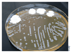 identification : prélèvement de colonie de bactéries et moisissures