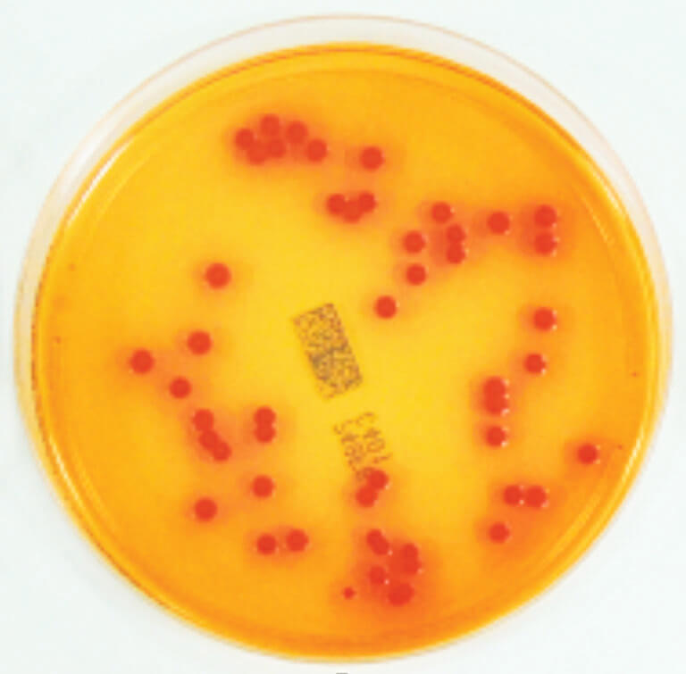 Burkholderia cepacia strikes again - Microbiology